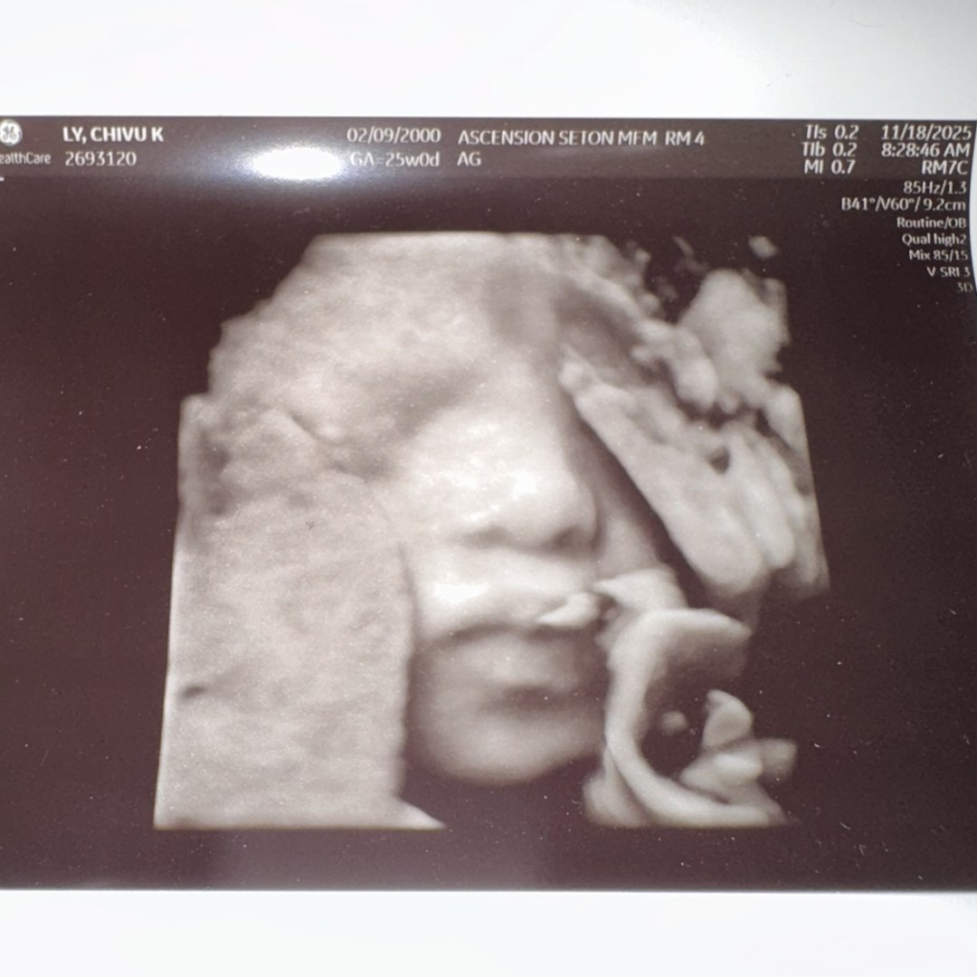 Photo shared by Chivu for their Babylist baby registry.