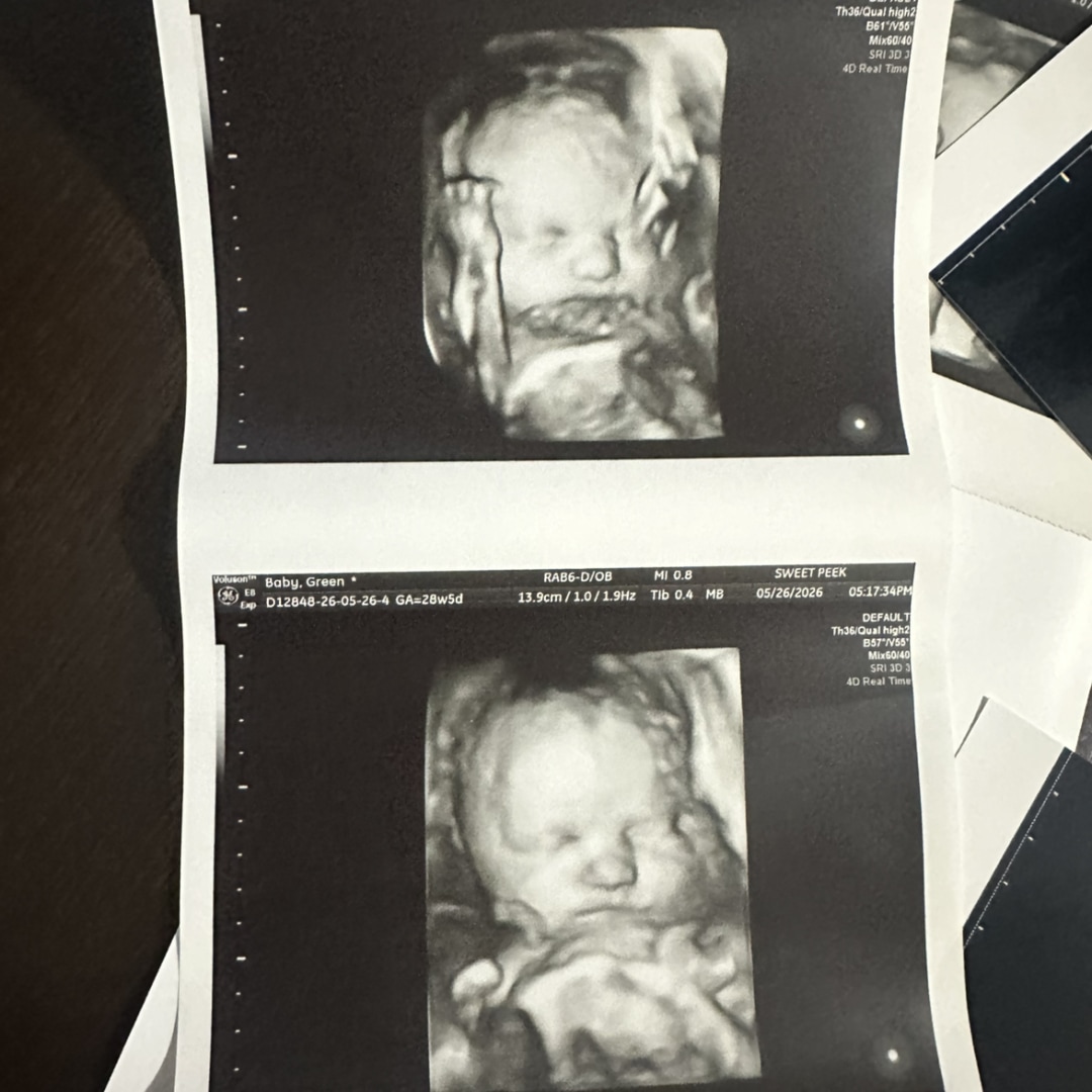 Photo shared by Caroline for their Babylist baby registry.