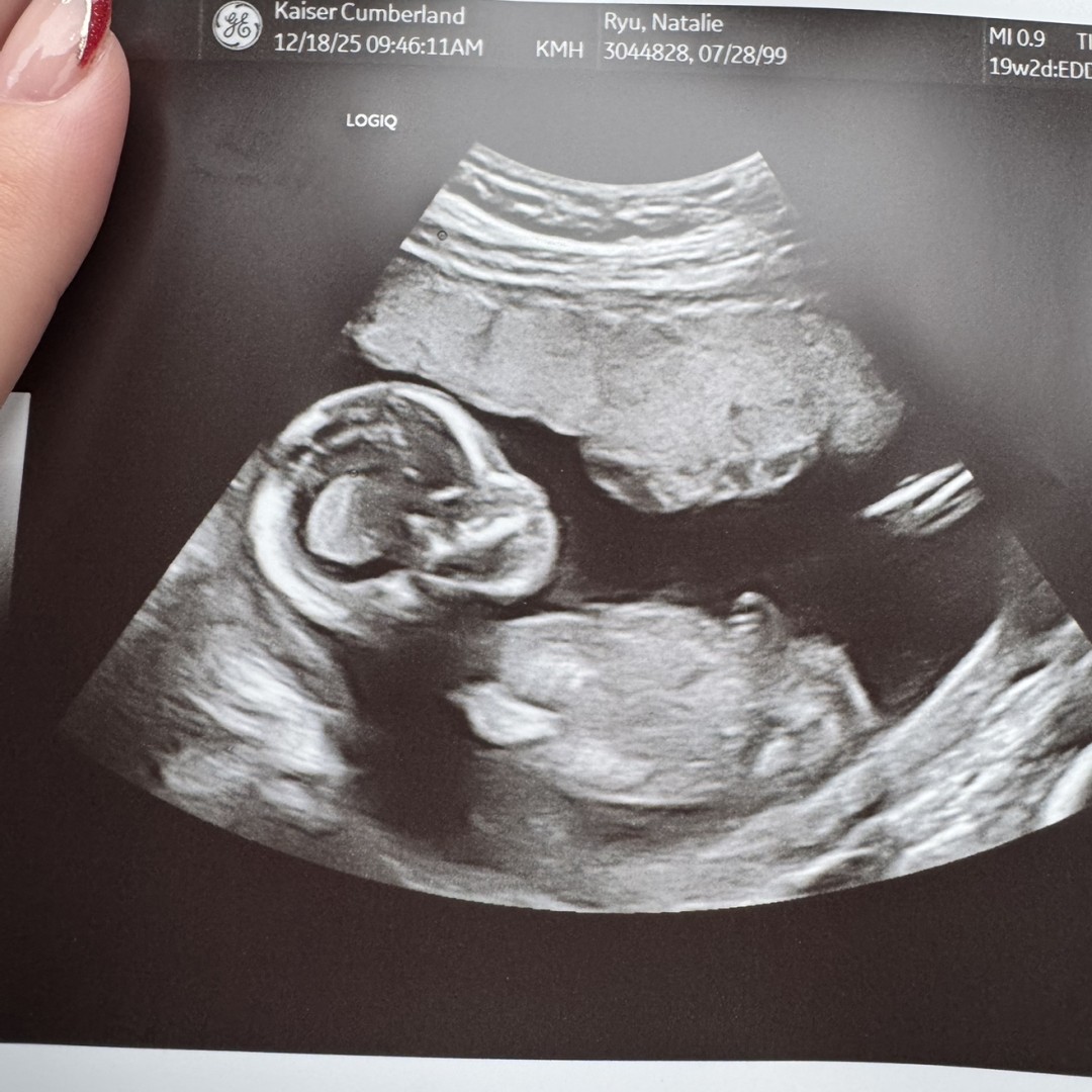 Photo shared by Natalie for their Babylist baby registry.