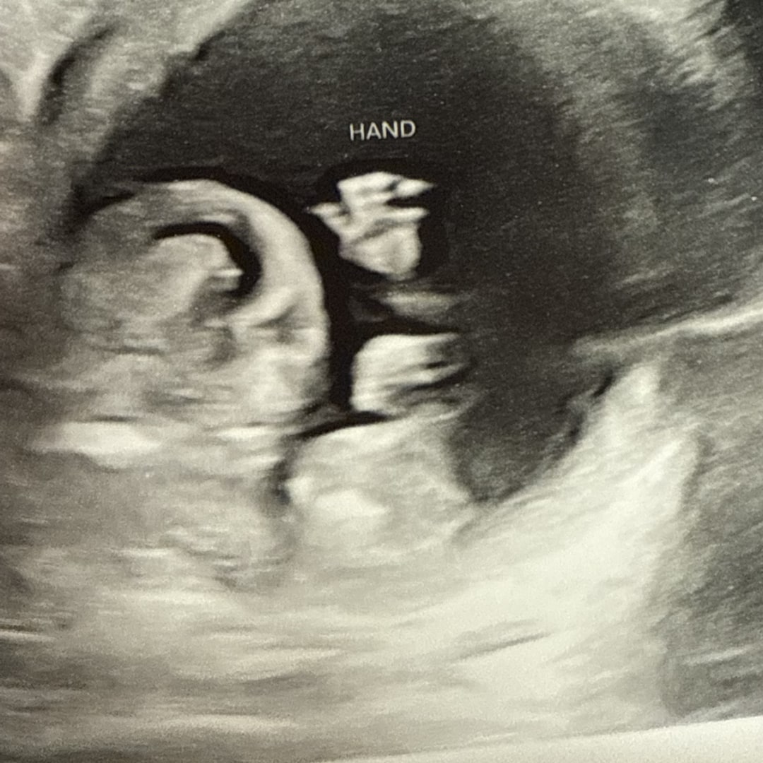 Photo shared by Jade for their Babylist baby registry.