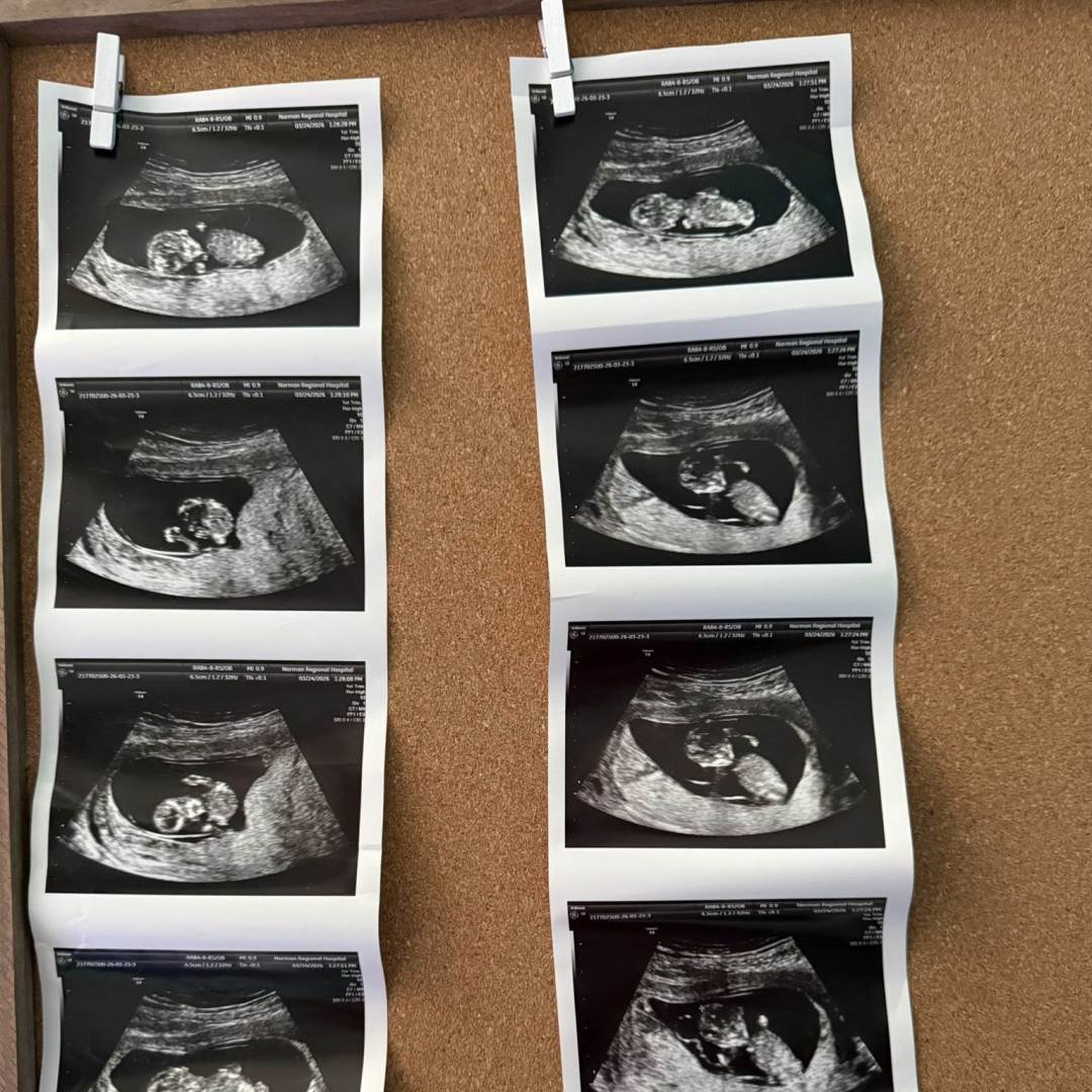 Photo shared by Shelby for their Babylist baby registry.