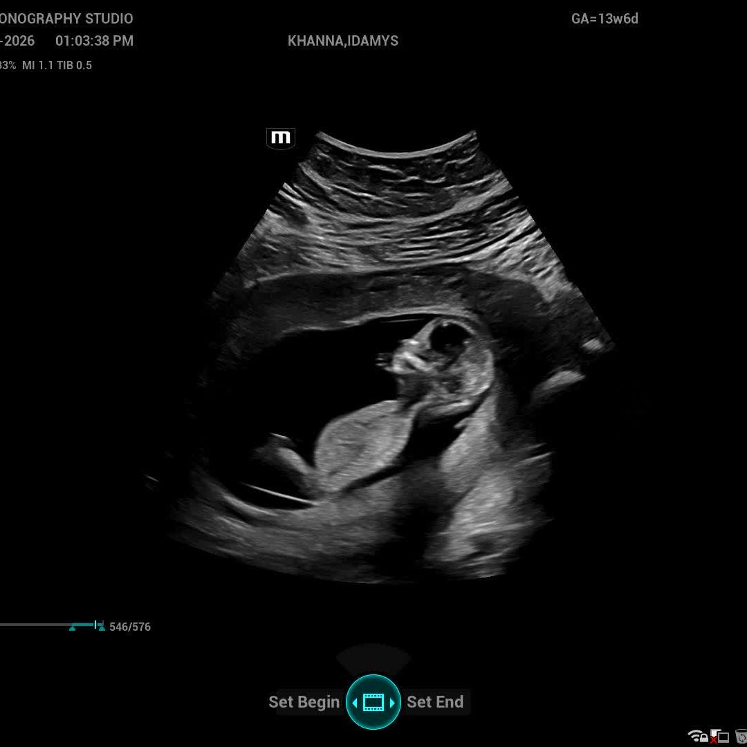 Photo shared by Idamys for their Babylist baby registry.