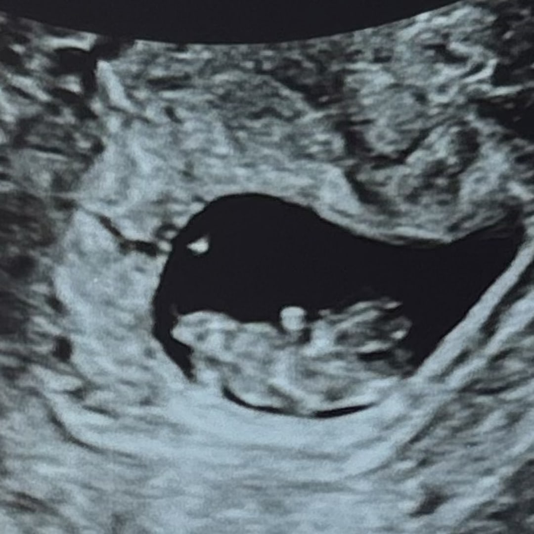 Photo shared by Raeannah for their Babylist baby registry.