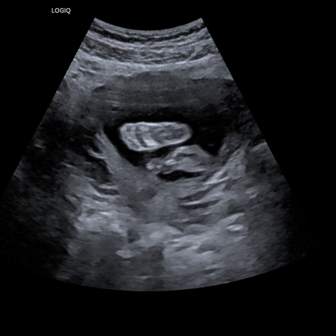 Photo shared by Blaize for their Babylist baby registry.