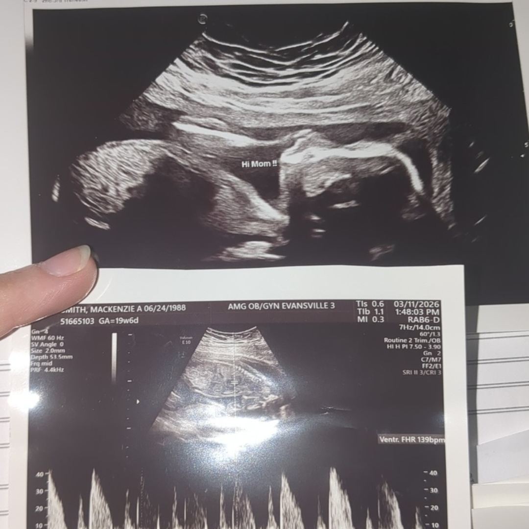 Photo shared by Mackenzie for their Babylist baby registry.