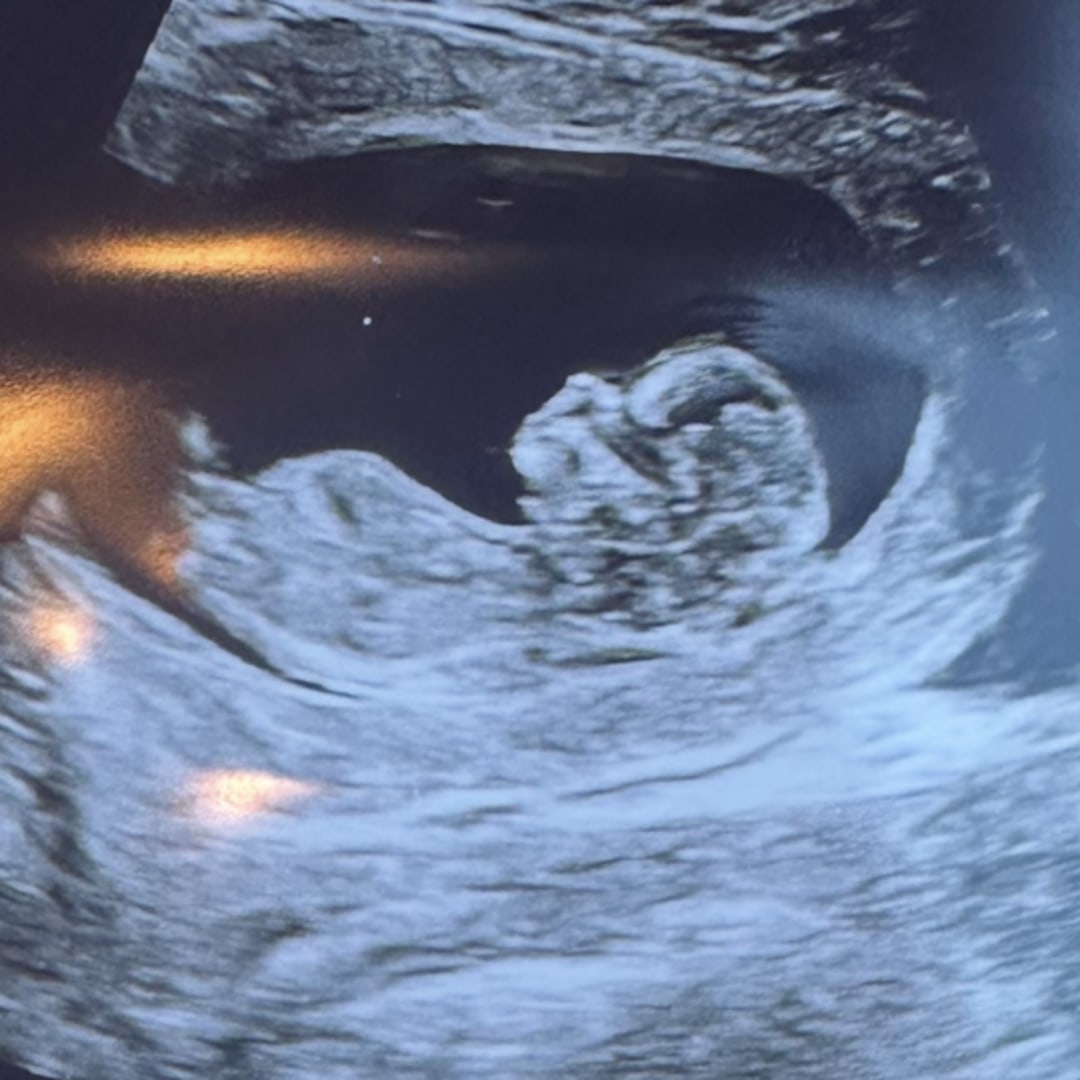 Photo shared by Ellen for their Babylist baby registry.