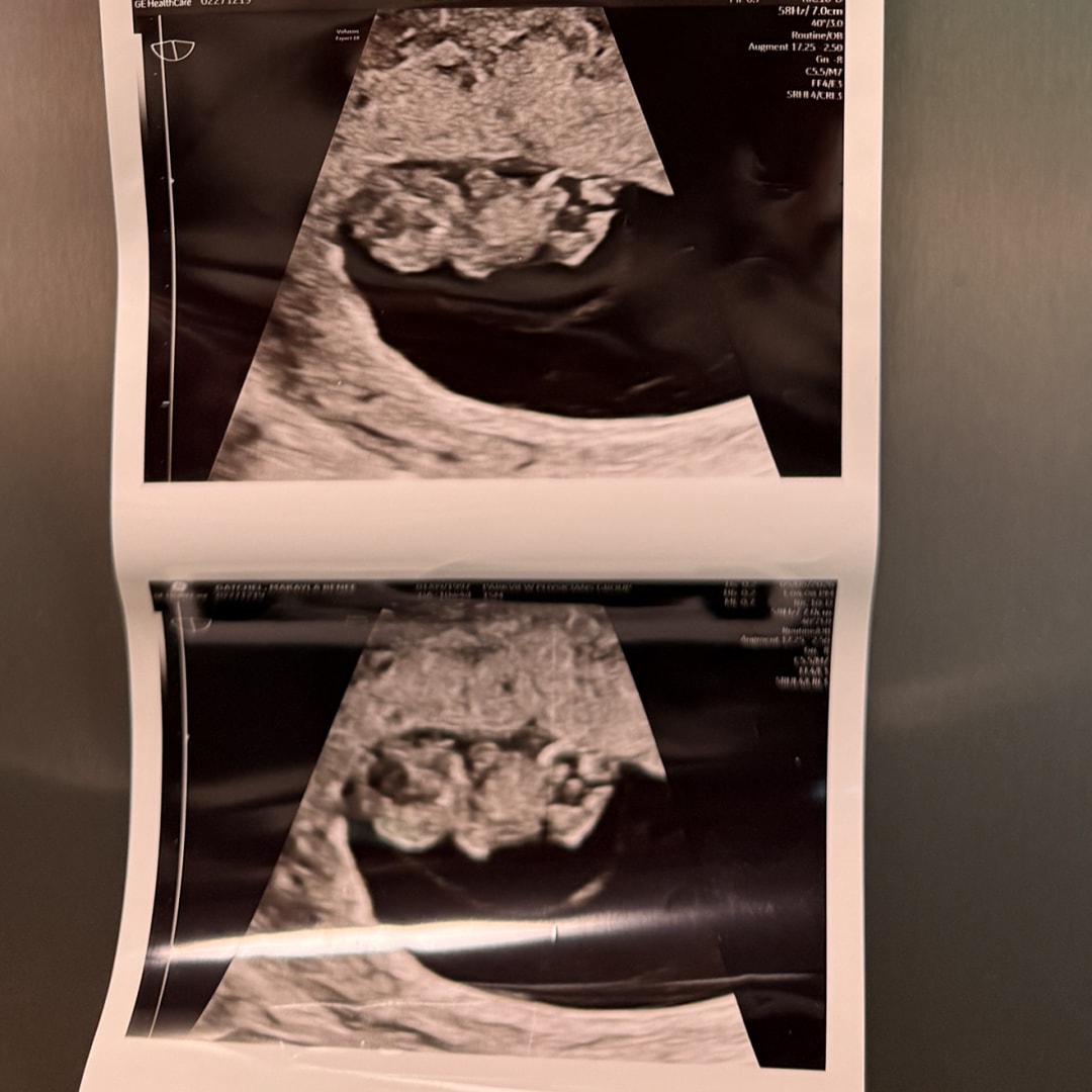 Photo shared by Makayla for their Babylist baby registry.