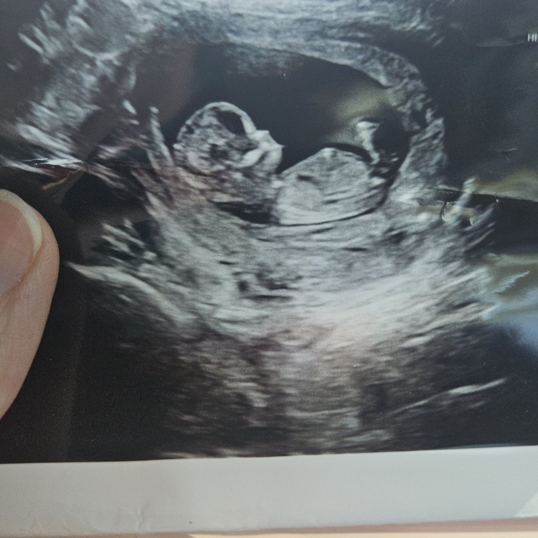 Photo shared by Jessica for their Babylist baby registry.