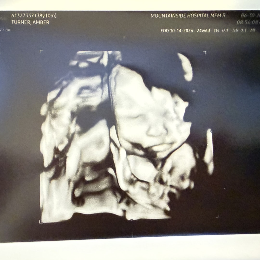 Photo shared by Amber for their Babylist baby registry.