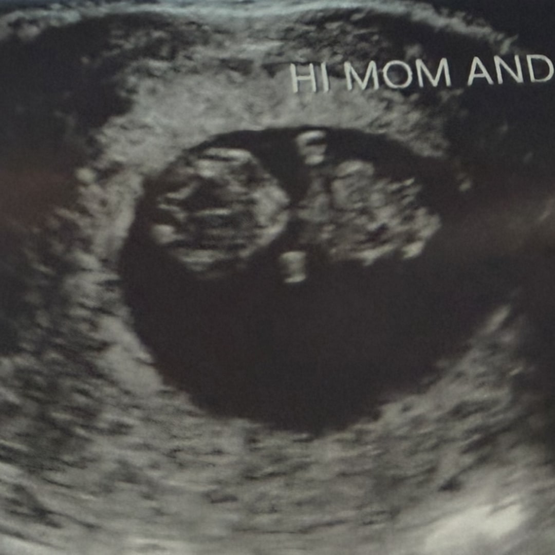 Photo shared by Meredith for their Babylist baby registry.