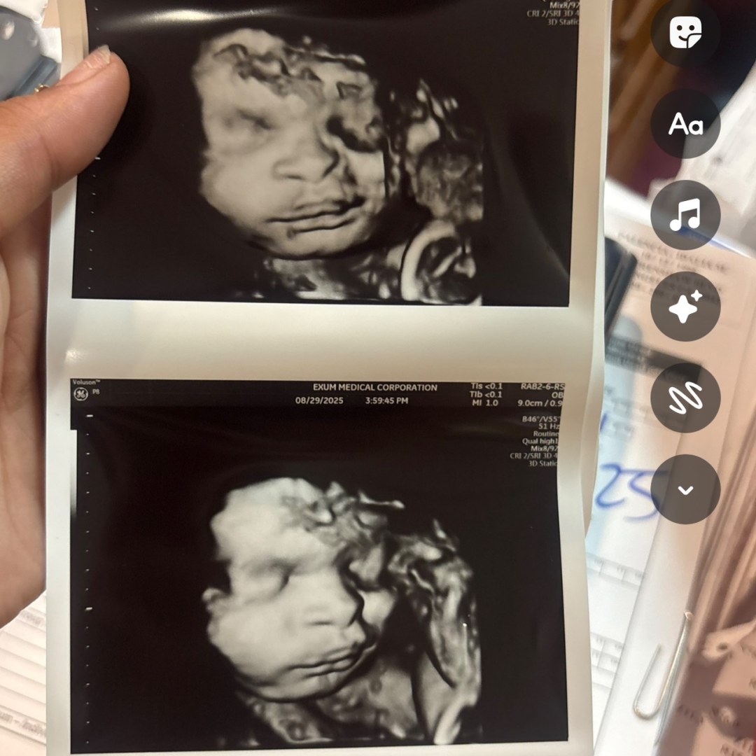 Photo shared by Jonnae for their Babylist baby registry.