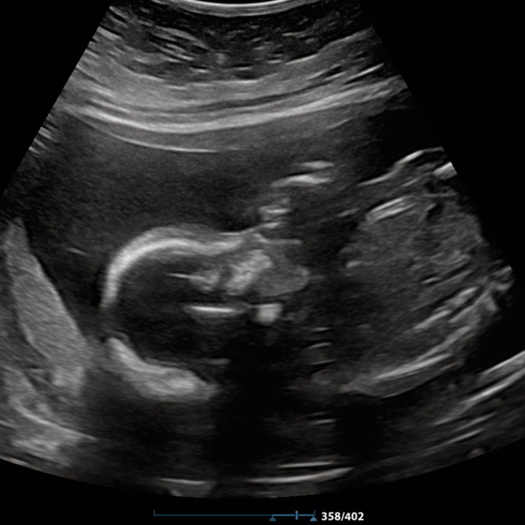 Photo shared by Emily for their Babylist baby registry.