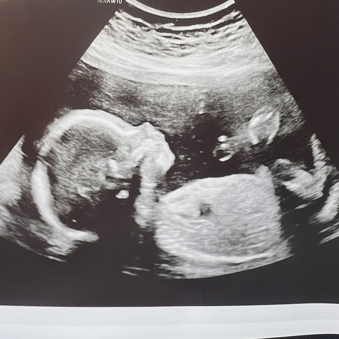 Photo shared by Courtney for their Babylist baby registry.