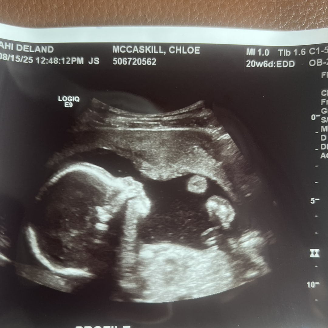 Photo shared by Chloe for their Babylist baby registry.