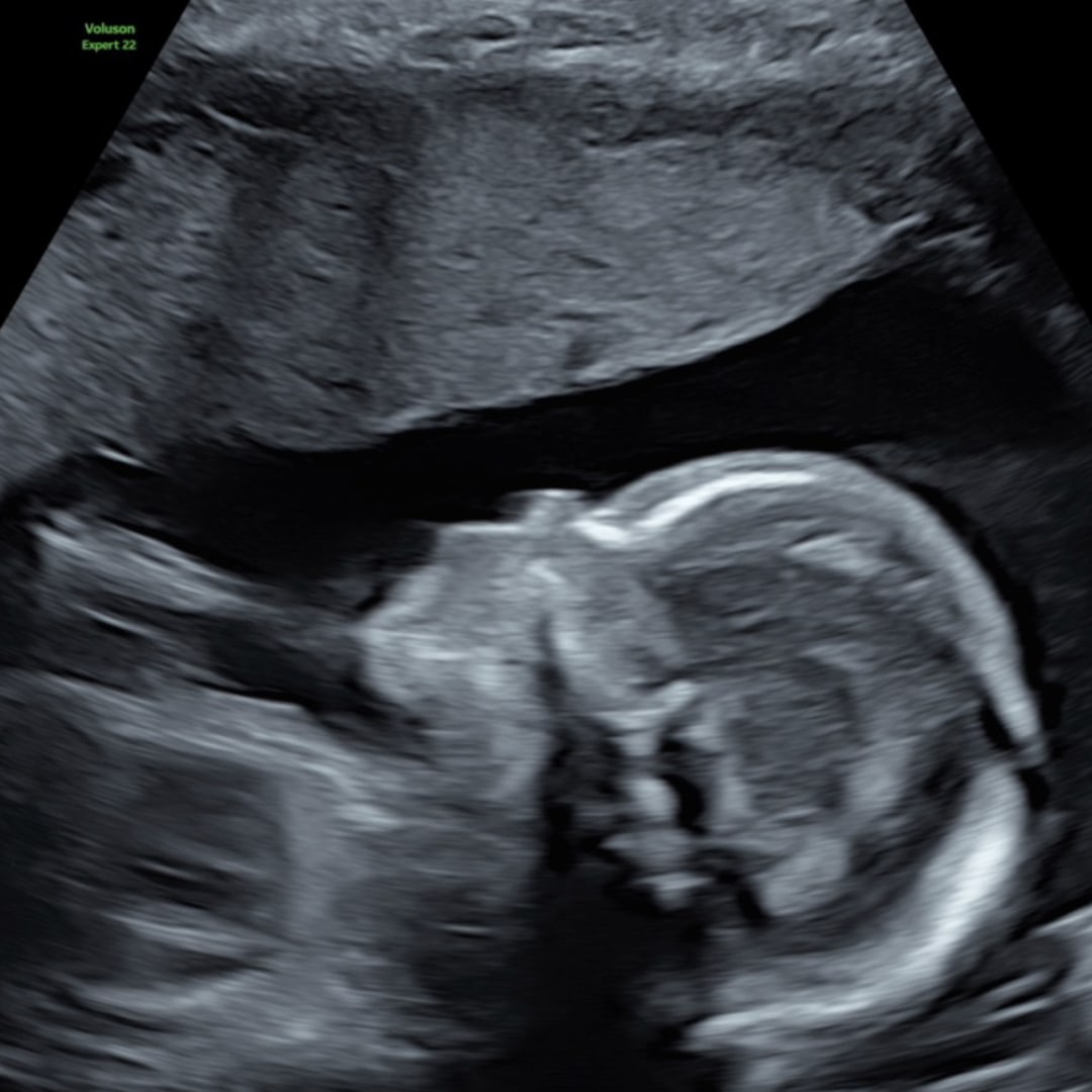 Photo shared by Ceylon for their Babylist baby registry.
