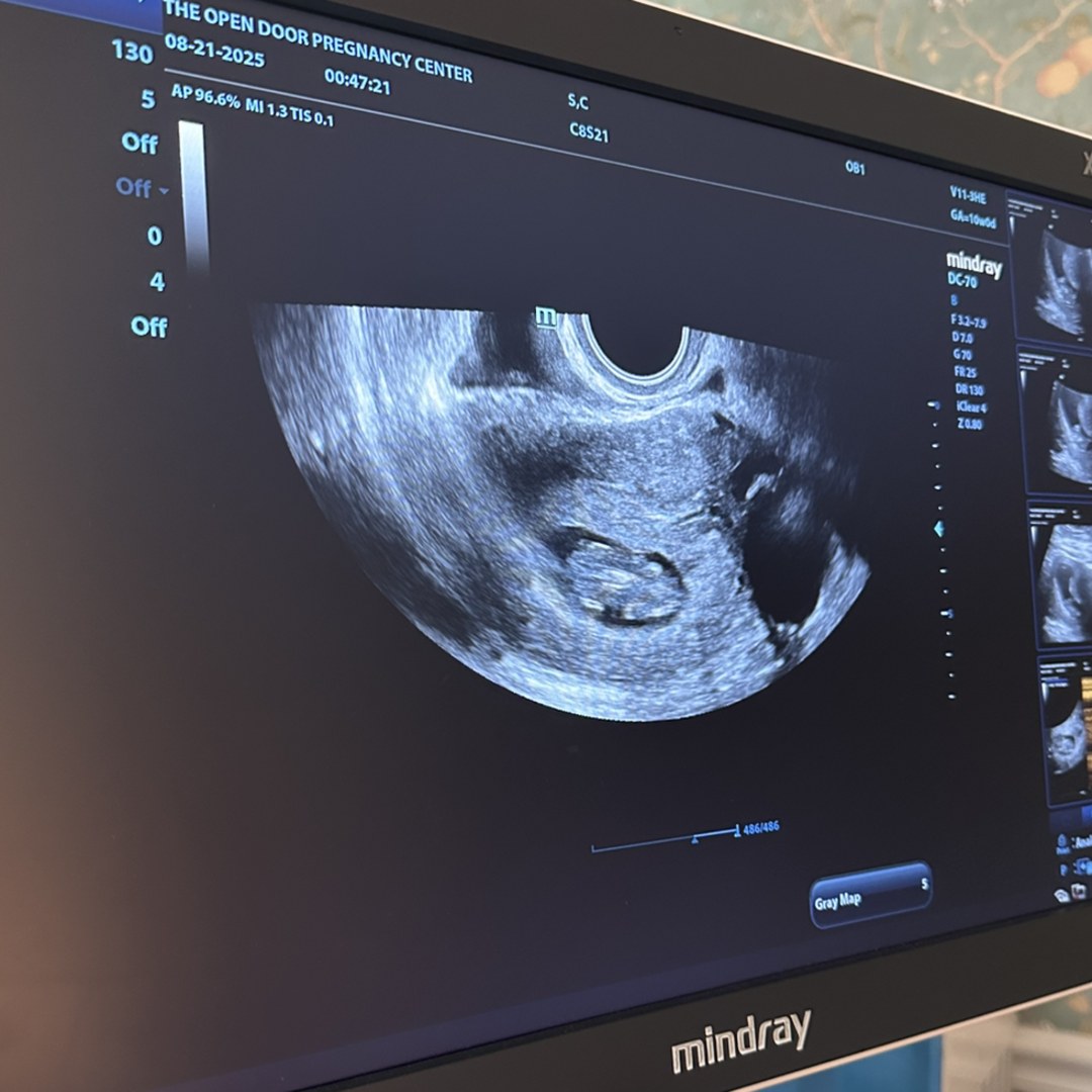 Photo shared by Claudia for their Babylist baby registry.