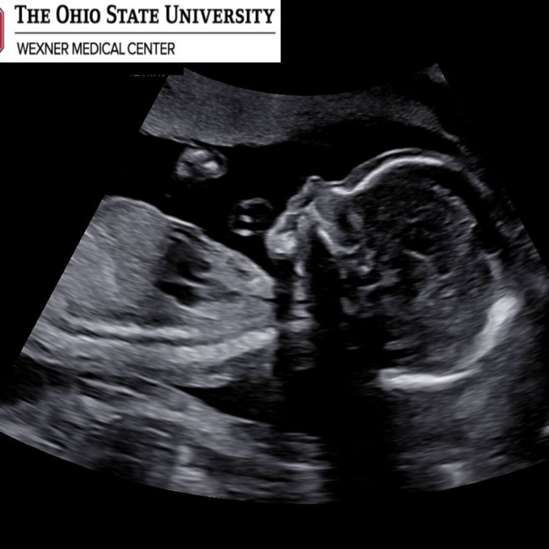 Photo shared by Lillia for their Babylist baby registry.