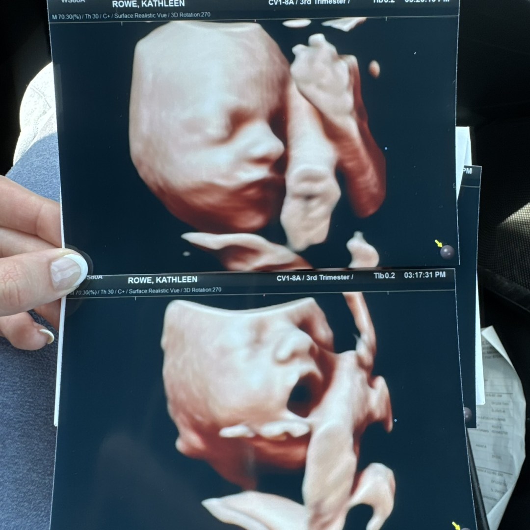 Photo shared by Kathleen & Garrett for their Babylist baby registry.