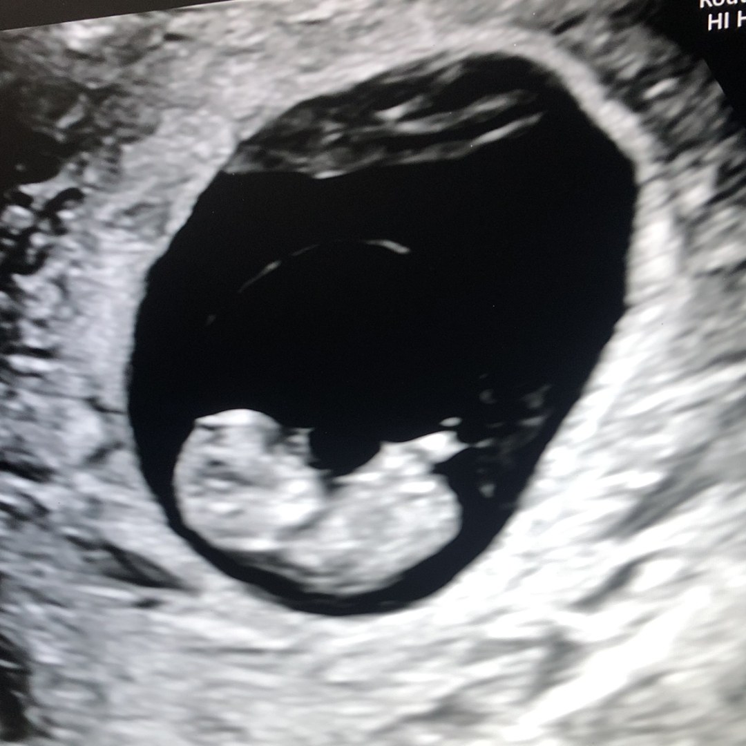 Photo shared by Stephanie for their Babylist baby registry.