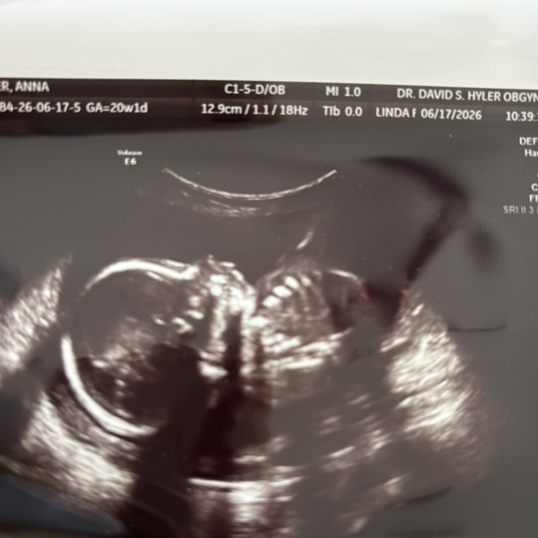 Photo shared by Anna for their Babylist baby registry.