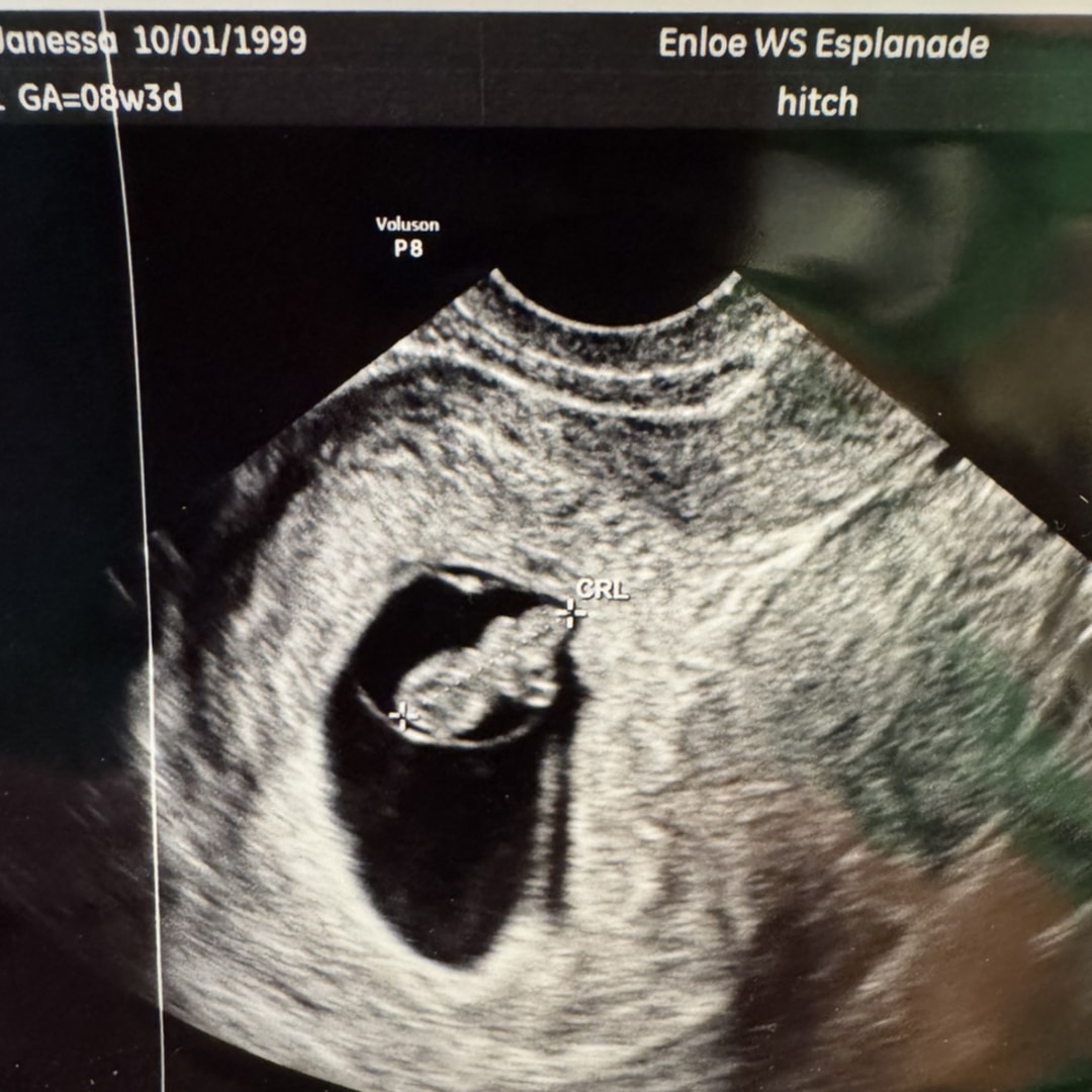 Photo shared by Janessa for their Babylist baby registry.