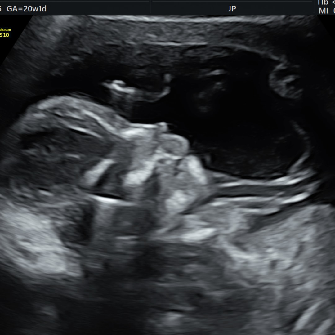 Photo shared by Bailey for their Babylist baby registry.