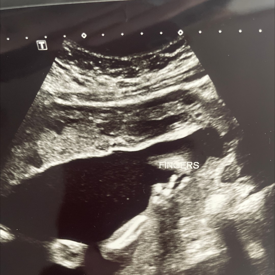 Photo shared by Kati for their Babylist baby registry.