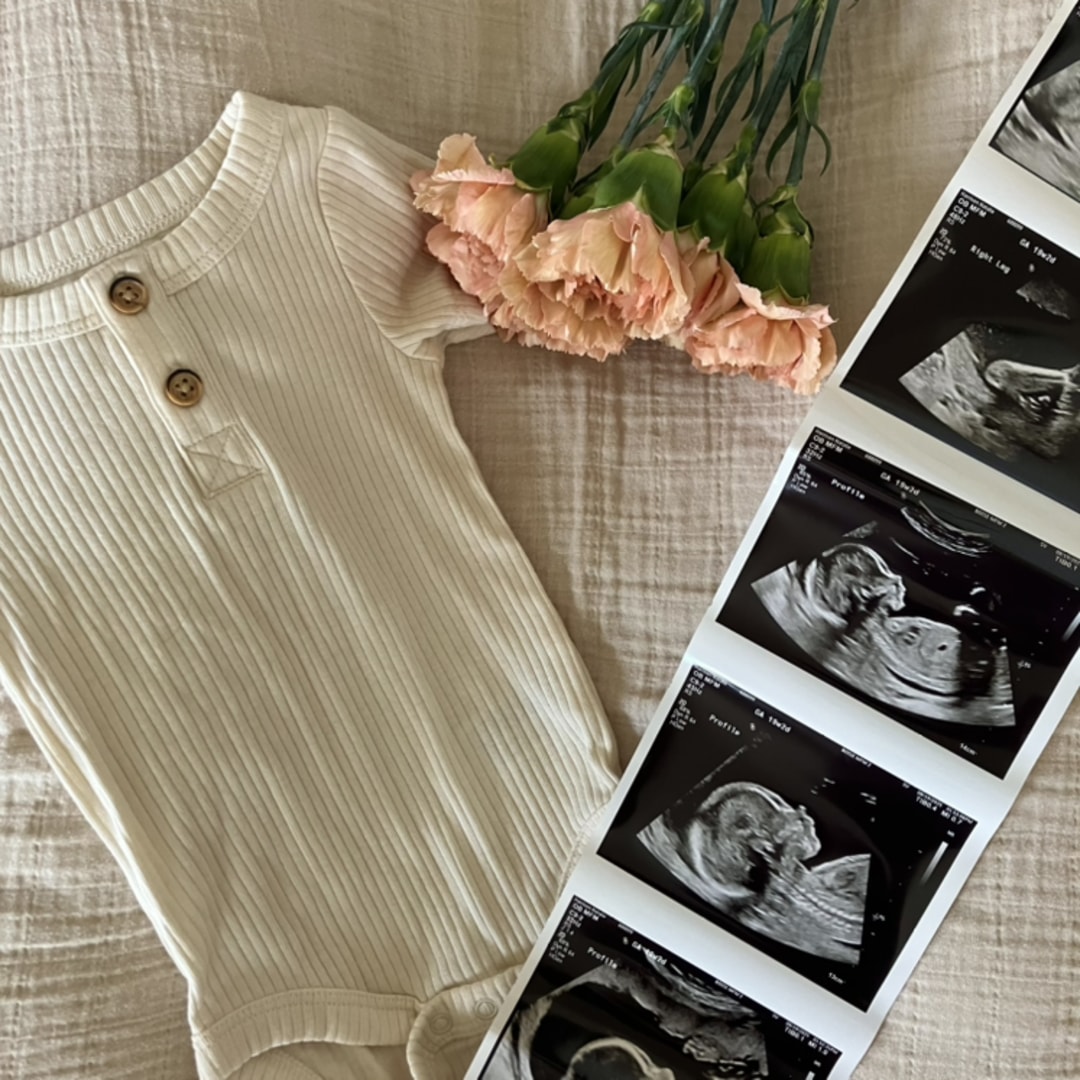 Photo shared by Natalie for their Babylist baby registry.