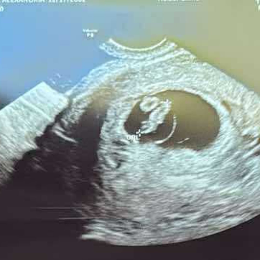 Photo shared by Alexanderia for their Babylist baby registry.