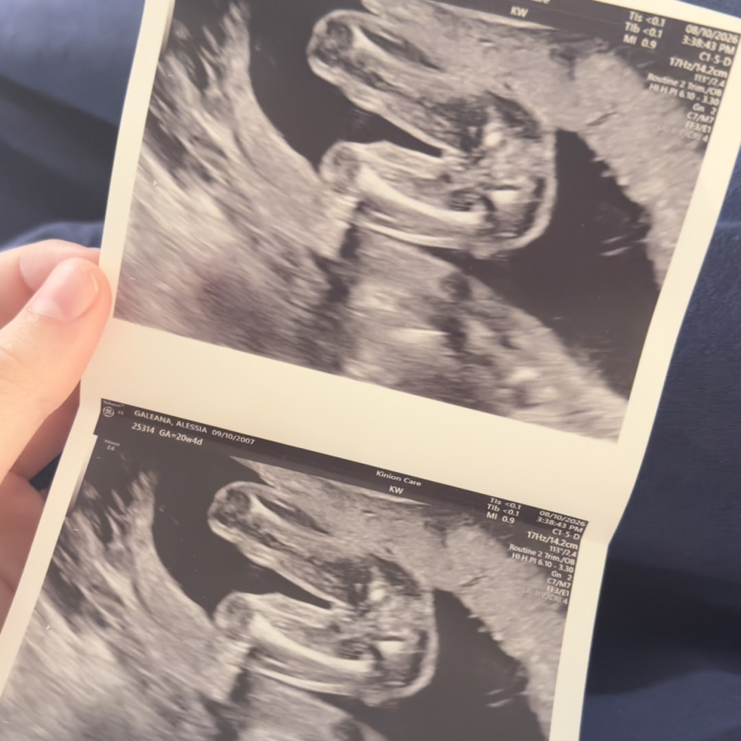 Photo shared by Alessia for their Babylist baby registry.