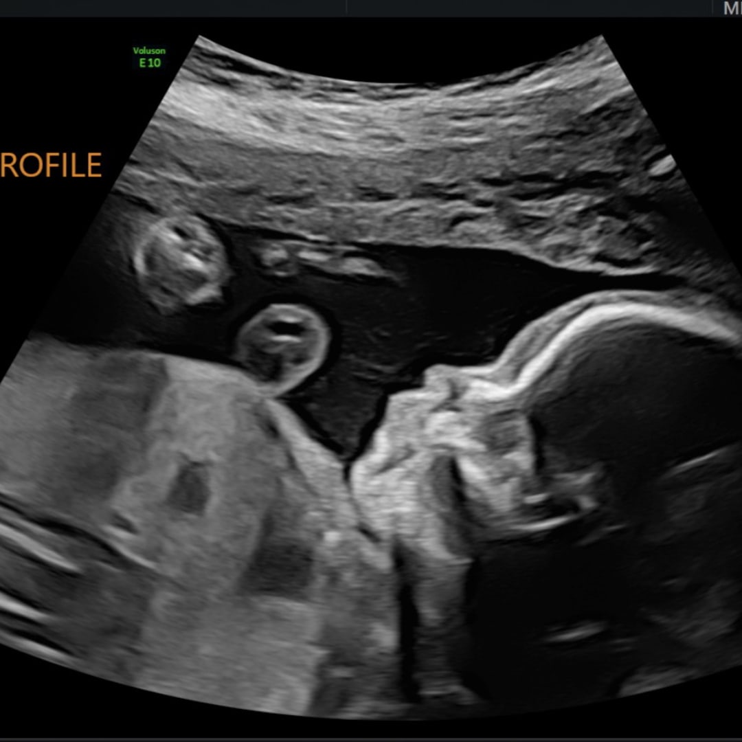 Photo shared by Danielle for their Babylist baby registry.