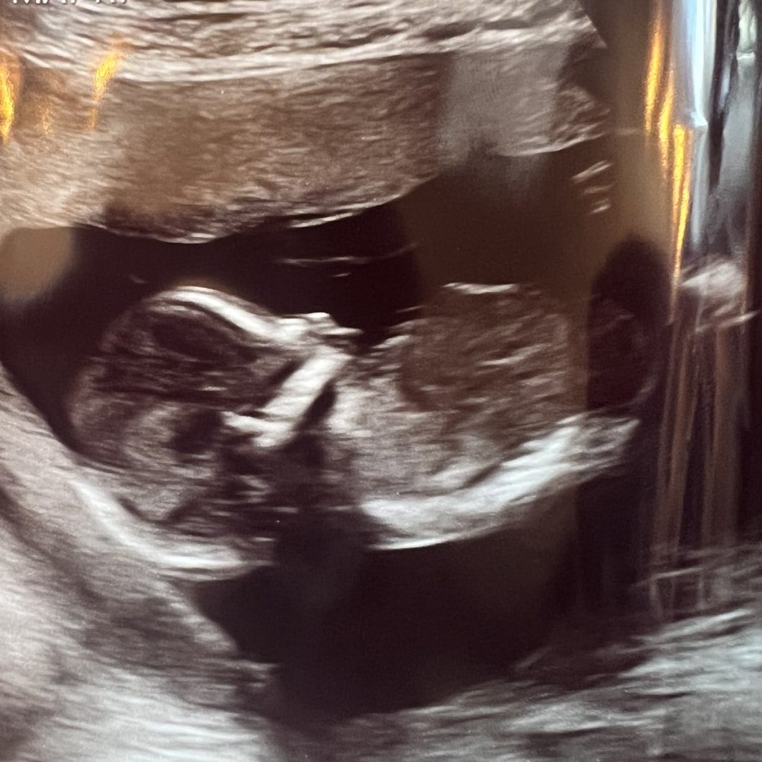 Photo shared by Annie for their Babylist baby registry.