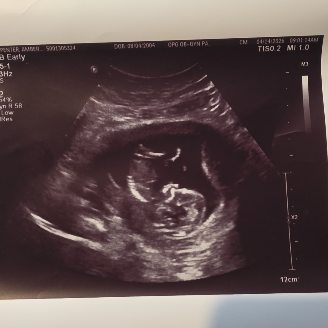 Photo shared by Amber for their Babylist baby registry.