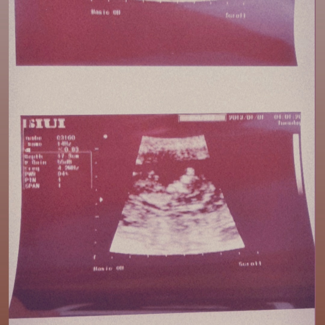 Photo shared by Paige for their Babylist baby registry.