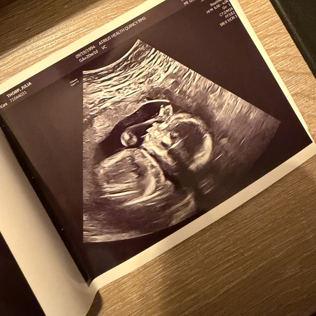 Photo shared by Julia for their Babylist baby registry.