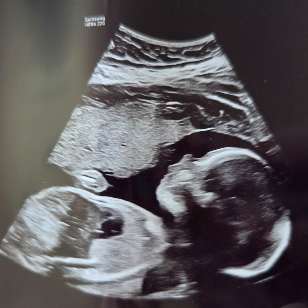 Photo shared by Gretchen for their Babylist baby registry.