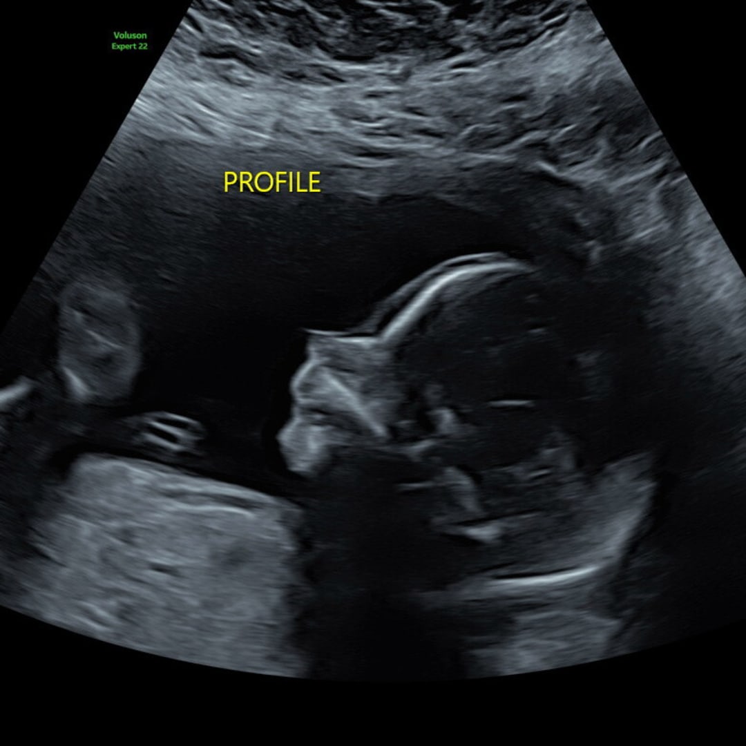 Photo shared by Meghan for their Babylist baby registry.