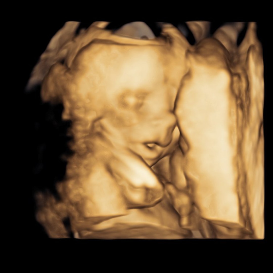 Photo shared by Jessica for their Babylist baby registry.