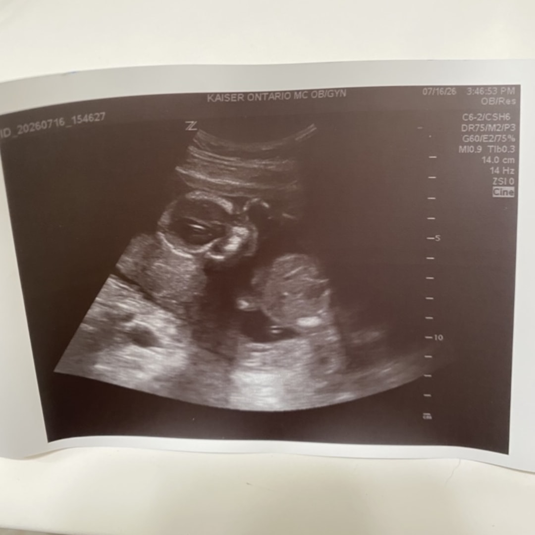 Photo shared by Sarah for their Babylist baby registry.