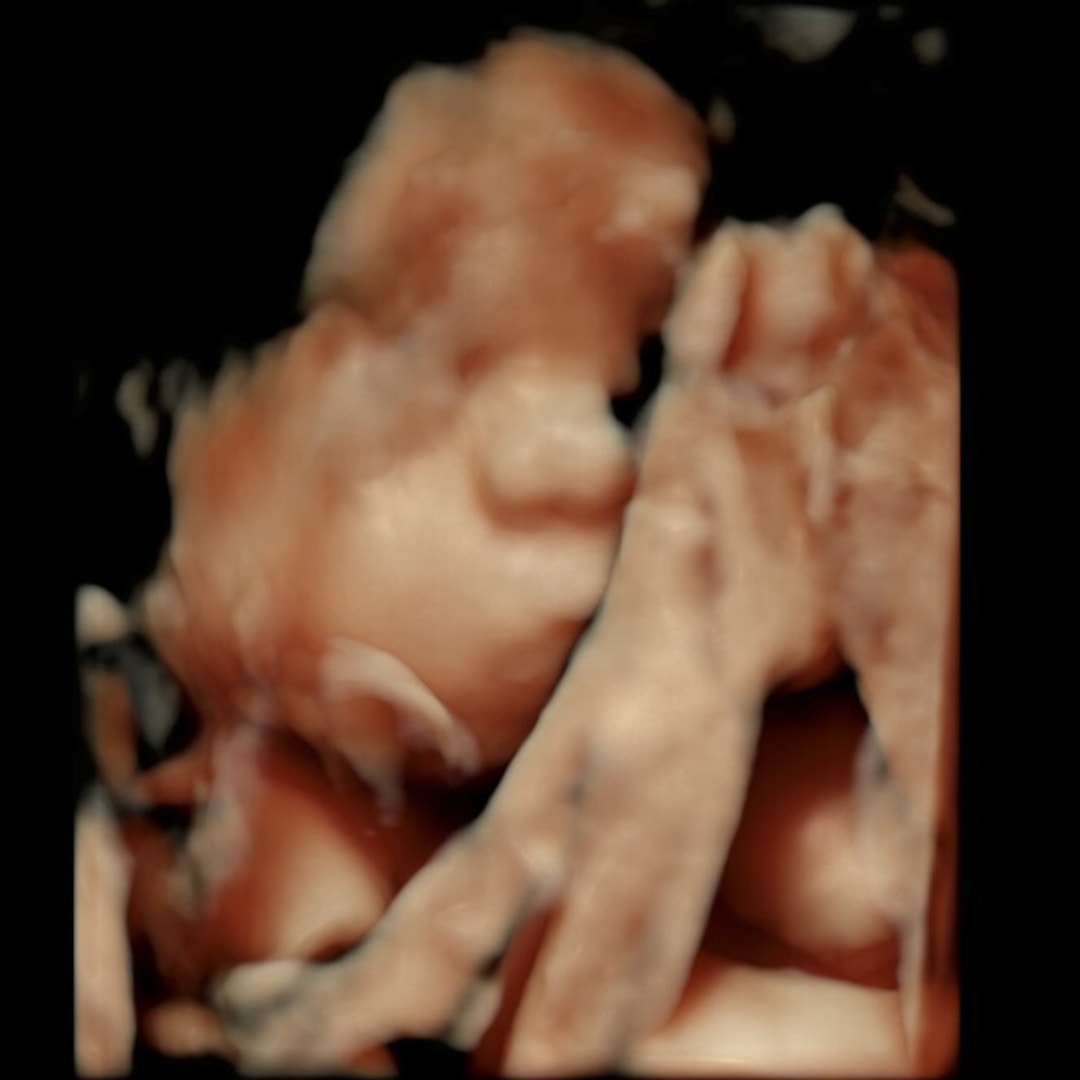 Photo shared by Anabelle for their Babylist baby registry.