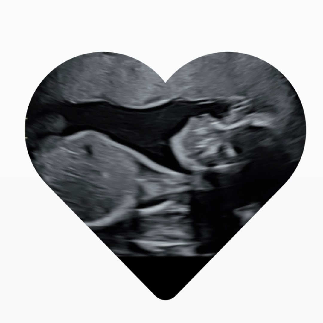 Photo shared by Jennifer for their Babylist baby registry.