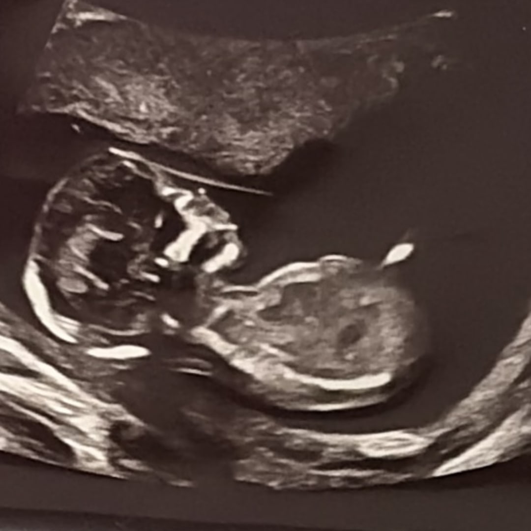 Photo shared by Alexis for their Babylist baby registry.