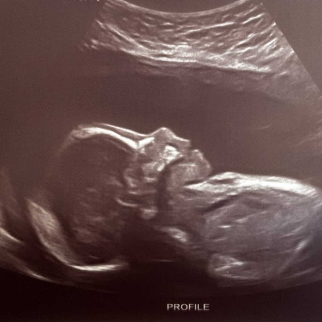 Photo shared by Jennifer for their Babylist baby registry.