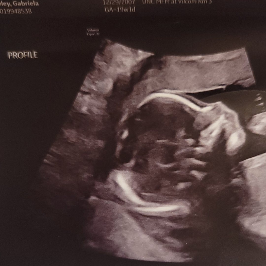 Photo shared by Gabriela for their Babylist baby registry.