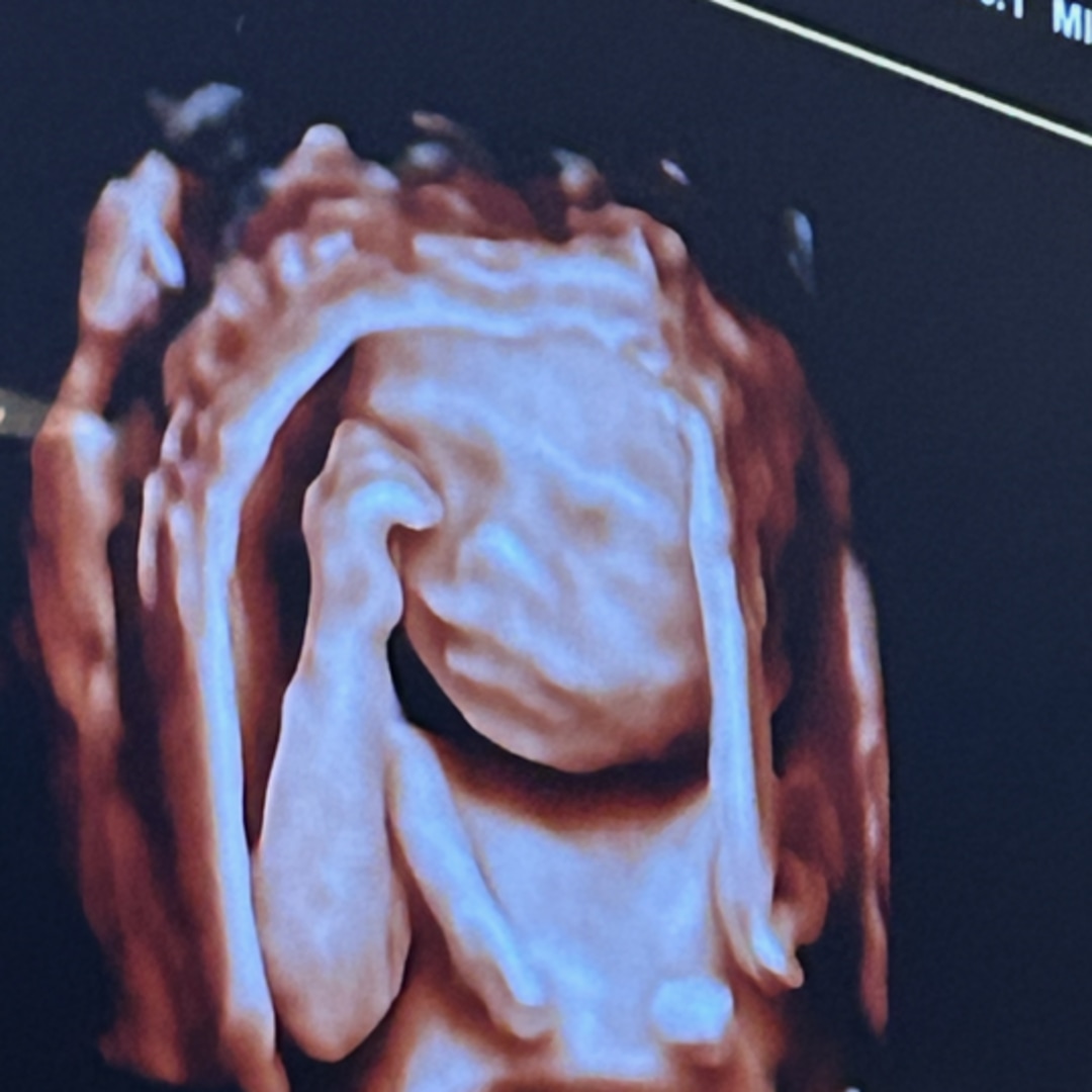 Photo shared by Kait for their Babylist baby registry.