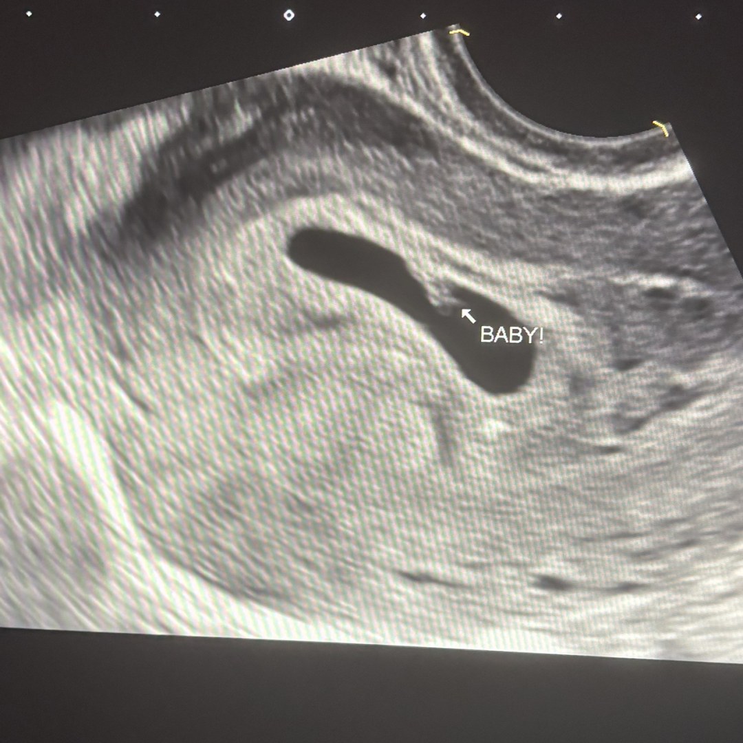 Photo shared by Emily for their Babylist baby registry.