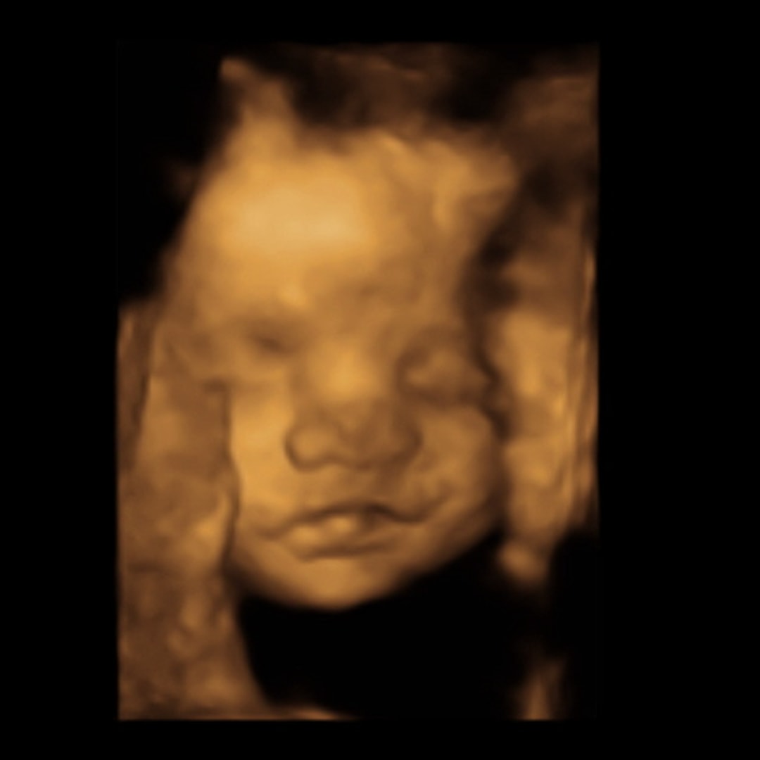 Photo shared by Alexis for their Babylist baby registry.