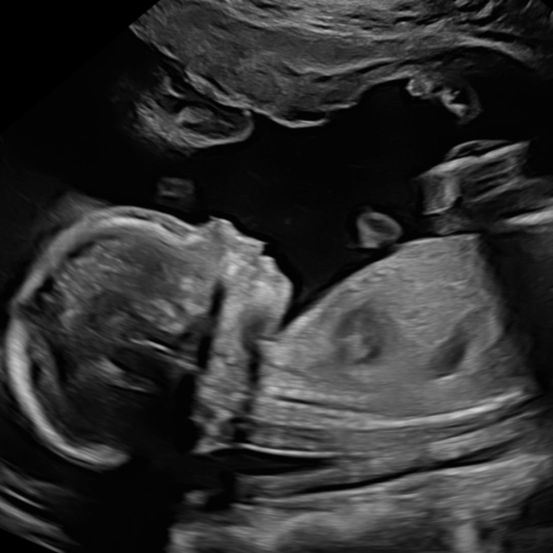 Photo shared by Gabi for their Babylist baby registry.