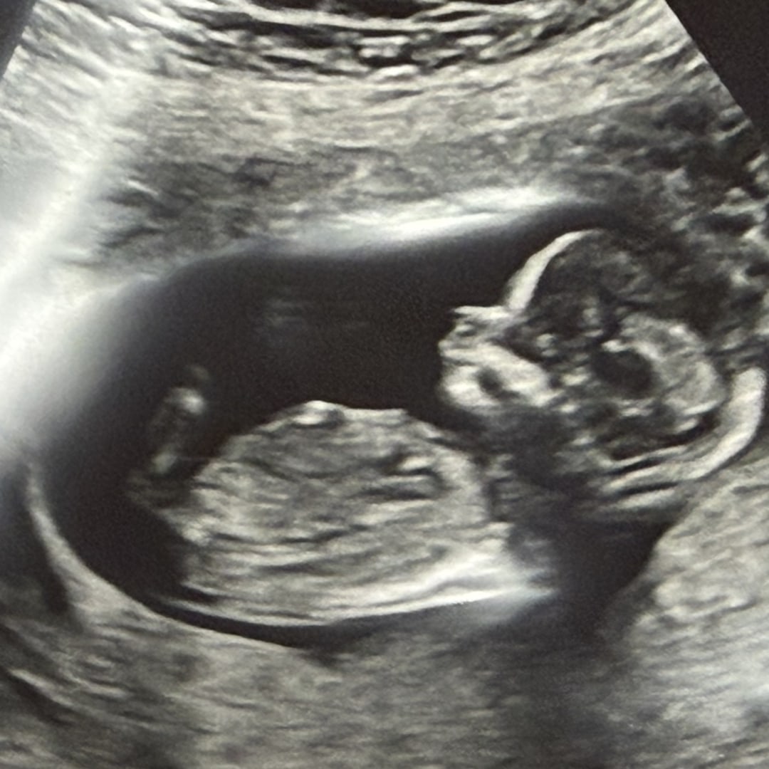 Photo shared by Emely for their Babylist baby registry.