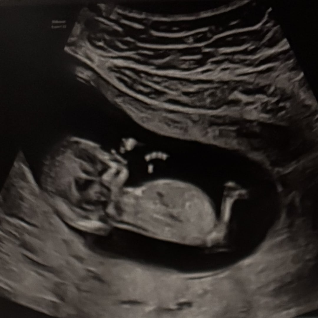 Photo shared by Ashley for their Babylist baby registry.